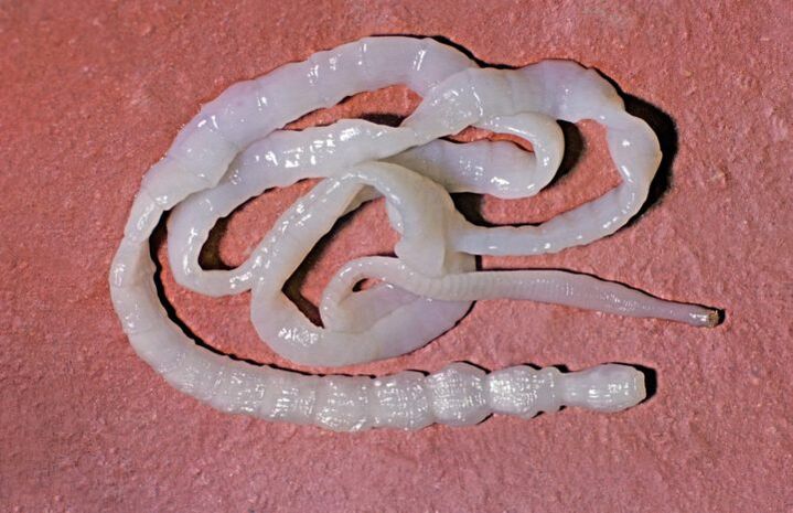 Txerri tapeworm